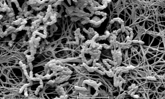 Achromobacter xylosoxidans, batteri filamentosi che colonizzano una matrice extracellulare fibrosa.