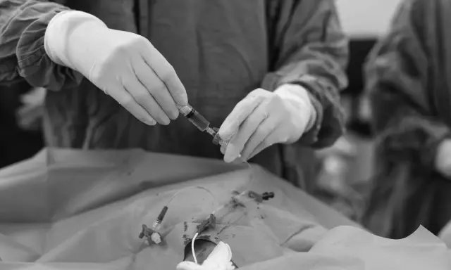 Mani guantate preparano una siringa per la picc chemio, un momento delicato di cura.