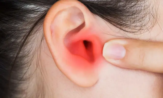 Dito un orecchio con un'area rossa che indica infiammazione, forse dovuta a pseudomonas aeruginosa orecchio.