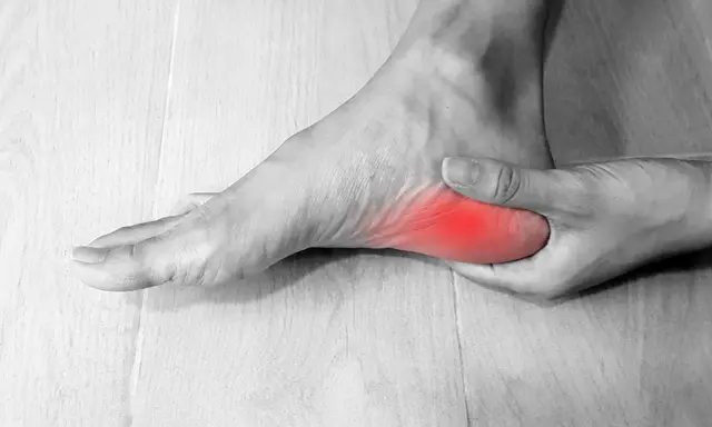 Pie con dolor en el talón, simulando fascitis plantar en niños.