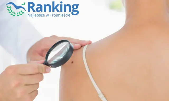 Dermatolog ogląda pieprzyk pod lupą na ramieniu pacjentki.