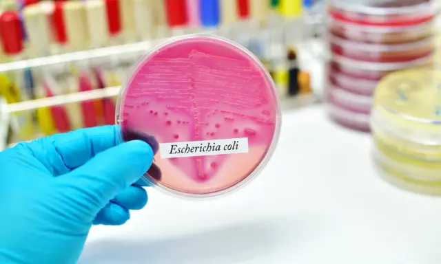 Różowa pożywka z koloniami bakterii Escherichia coli. Badanie laboratoryjne pomaga wykryć bakteria coli objawy.