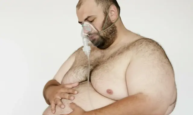Mann mit Sauerstoffmaske, dessen stark übergewichtiger Körper auf eine ausatmung erschwert hindeutet.