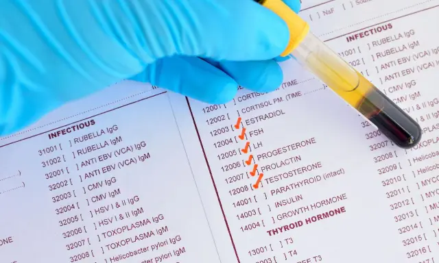Rękawiczka w niebieskiej rękawiczce trzyma probówkę z krwią nad listą badań, w tym ESTRADIOL, FSH, LH, PROGESTERON, TESTOSTERON, co może pomóc w zrozumieniu, jak podnieść poziom estrogenu.