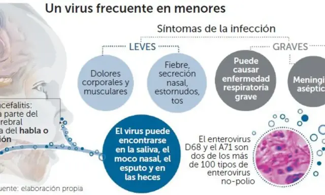 Infografía sobre enterovirus en niños, detallando síntomas leves y graves, dónde se encuentra el virus y tipos específicos como D68 y A71.