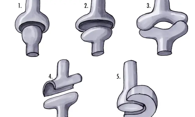 Fünf schematische Darstellungen von mechanische Gelenke Beispielen, die verschiedene Bewegungsarten illustrieren.