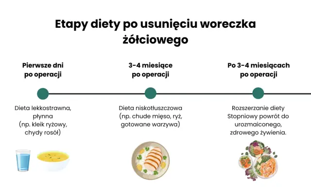 Etapy diety po operacji woreczka żółciowego: płynna dieta lekkostrawna, potem niskotłuszczowa, aż do powrotu do zdrowego żywienia.
