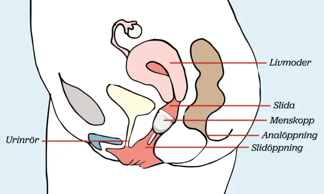 Illustration visar hur en menskopp placeras i slidan för att samla upp mensblod.