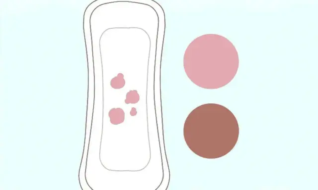Compresa con manchas rosadas, indicando spotting intermenstrual. Dos círculos de colores, uno rosa claro y otro marrón, acompañan la imagen.