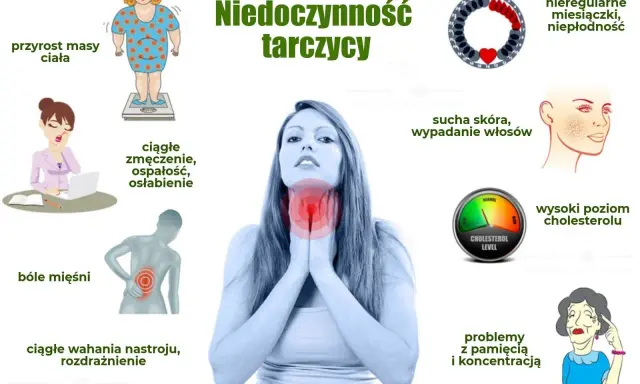 Objawy niedoczynności tarczycy: przyrost masy ciała, zmęczenie, bóle mięśni, wahania nastroju, sucha skóra, wypadanie włosów, problemy z pamięcią.