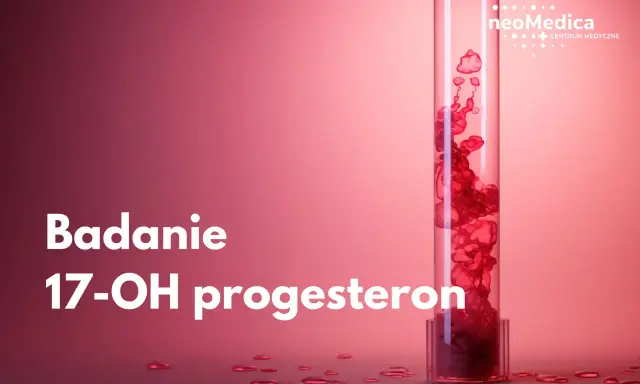 Badanie 17-OH progesteron. Podwyższony poziom może wiązać się z objawami takimi jak trądzik czy nadmierne owłosienie.