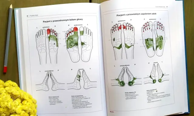 Ilustracje pokazują punkty na dłoniach odpowiadające narządom, używane w terapii refleksologicznej.