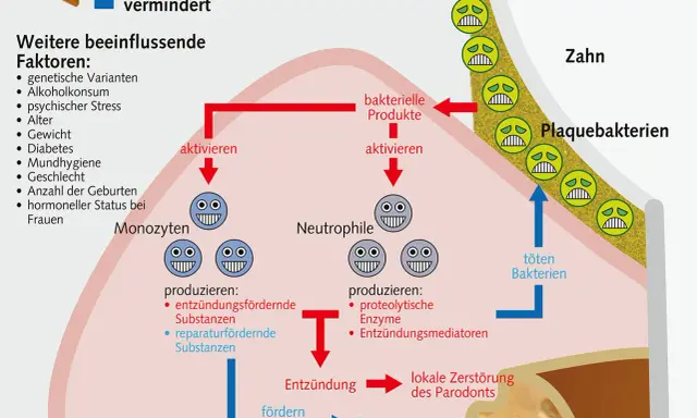 Das Diagramm zeigt, wie sich das Zahnfleisch nach Rauchstopp regeneriert. Es erklärt die Rolle von Monozyten und Neutrophilen bei Entzündung und Reparatur.