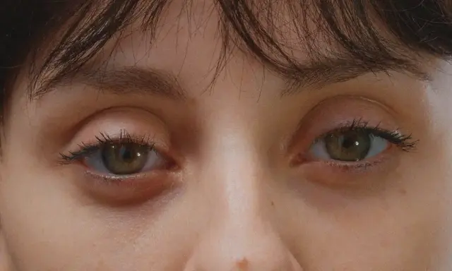 Gros plan sur des yeux verts, l'un d'eux présente une poche sous l'œil gonflée, signe d'une nuit agitée.