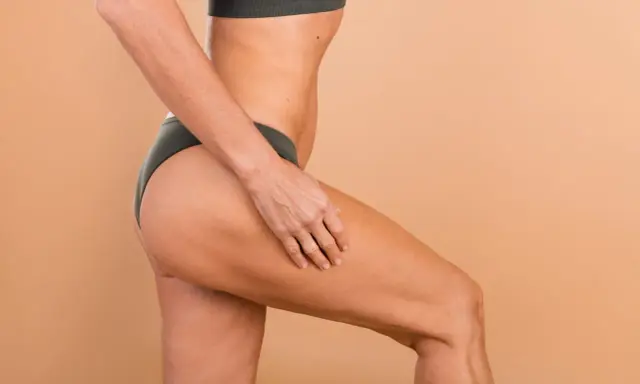 Une femme touche sa cuisse, montrant la peau et les effets de la cellulite. Des solutions pour enlever cellulite cuisse existent.