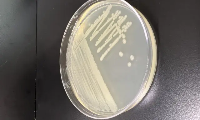 Colonia di batteri su piastra di Petri, forse Pseudomonas putida, con crescita a strisce e colonie isolate.