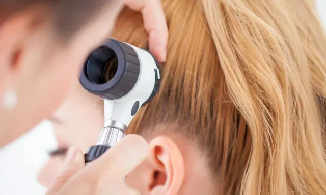 Un dermatologo esamina il cuoio capelluto con un dermatoscopio, eseguendo un pull test per valutare la caduta dei capelli.