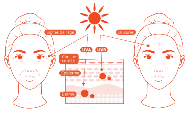 Le soleil émet des rayons UVA et UVB qui causent des signes de l'âge et des brûlures sur la peau.