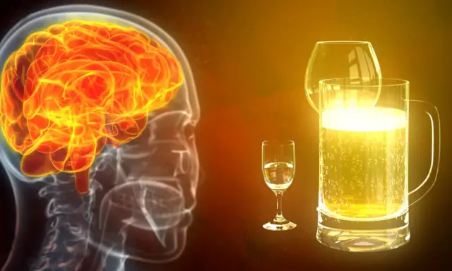 Jasny mózg w profilu, obok kieliszek i kufel piwa. Obraz symbolizuje demencję alkoholową i jej wpływ na mózg.