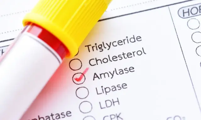 Esame del sangue con provetta e modulo di analisi. La casella "Amylase" è spuntata, indicando un controllo dei valori normali di amilasi.