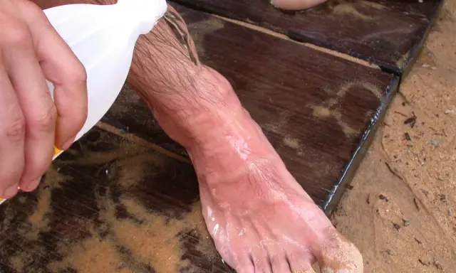 Piede bagnato sulla sabbia, con liquido versato da una bottiglia. Forse un rimedio dopo un incontro con una medusa Chrysaora hysoscella.