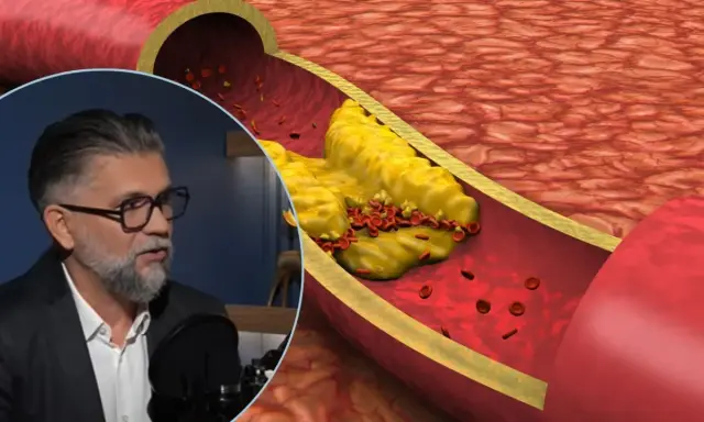 Mężczyzna w okularach opowiada o tym, jak wyleczył miażdżycę, podczas gdy na ekranie widać przekrój tętnicy z cholesterolem i czerwonymi krwinkami.