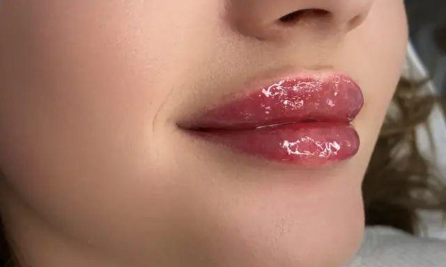 Błyszczące, pełne usta baby doll po zabiegu makijażu permanentnego.