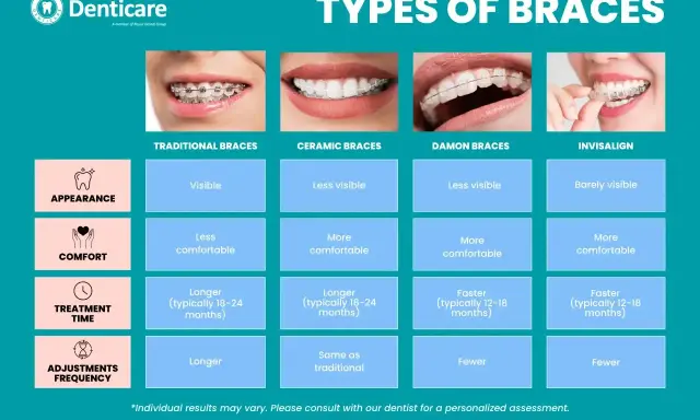 Porównanie aparatów ortodontycznych: tradycyjne, ceramiczne, Damon i Invisalign. Zęby wysunięte do przodu mogą być korygowane.