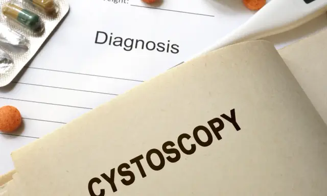 Na dokumentach medycznych, obok leków i termometru, widnieje napis "CYSTOSCOPY". Czas trwania cystoskopii jest kluczowy dla pacjenta.