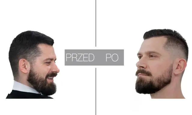 Przed i po: mężczyzna z brodą przed i po zabiegu konturowania brody.