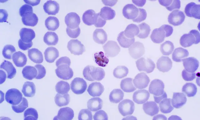 Microscopic view of red blood cells with a malaria parasite.
