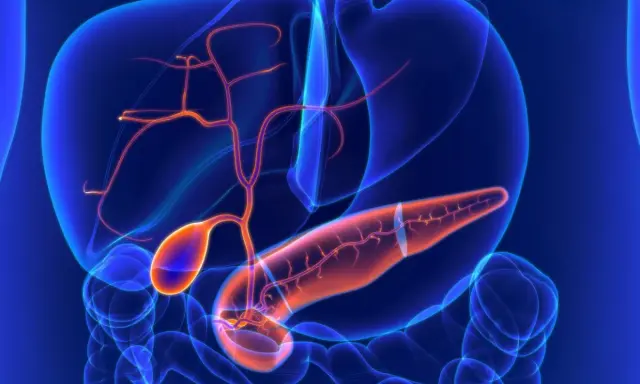 Anatomia jamy brzusznej z widoczną trzustką, wątrobą i pęcherzykiem żółciowym. Widać naczynia krwionośne. Może to być wizualizacja torbieli na trzustce.
