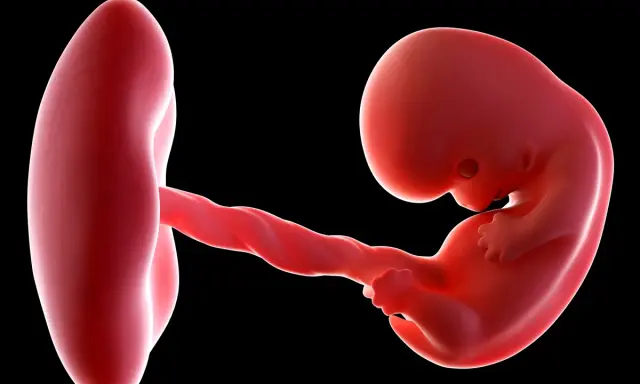 Płód w 8 tygodniu ciąży, wielkość dziecka porównywalna do fasolki, połączony skręconą pępowiną z pęcherzykiem żółtkowym.
