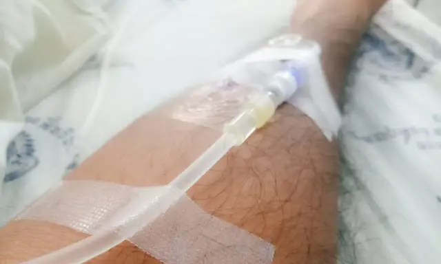 Ręka z założonym cewnikiem dializacyjnym, widoczna jest taśma medyczna i fragment pościeli szpitalnej. Pielęgnacja cewnika dializacyjnego jest kluczowa.