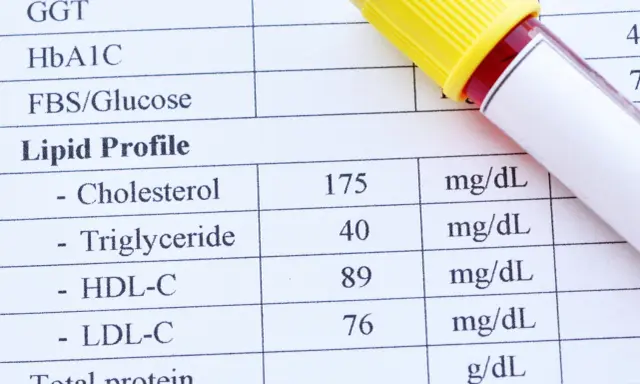 Wyniki lipidogramu: cholesterol 175, trójglicerydy 40, HDL-C 89, LDL-C 76 mg/dL.