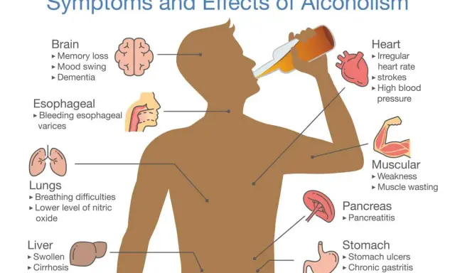 Ilustracja pokazuje, że alkohol to trucizna, która wpływa na mózg, serce, płuca, wątrobę, trzustkę i żołądek, powodując różne schorzenia.