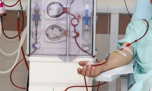 Dializator to urządzenie do prowadzenia terapii oczyszczającej krew. Pacjent podłączony do maszyny, widoczna jego ręka z kaniulą i czerwonymi przewodami.