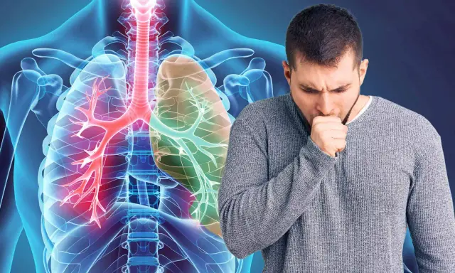 Mann hustet, Lunge mit COPD-Symptomen. Appetitlosigkeit kann ein Zeichen sein.