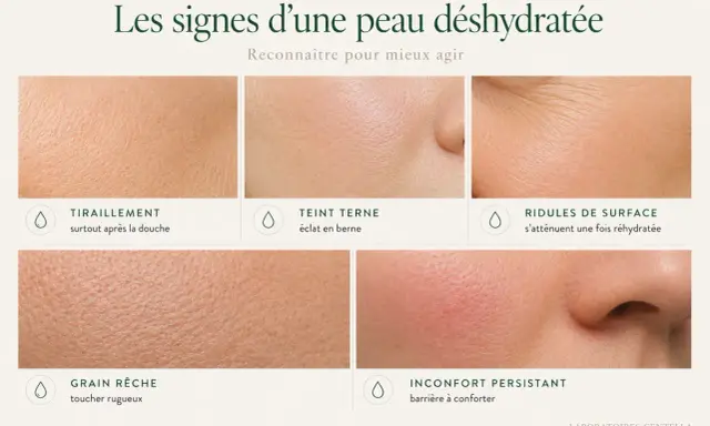 Les signes d'une peau déshydratée : tiraillements, teint terne, ridules, grain rêche et inconfort. Reconnaître ces signes pour mieux agir.