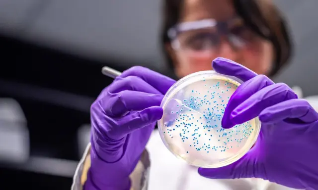 Naukowczyni w fioletowych rękawiczkach bada szalkę Petriego z koloniami bakterii, w tym escherichia coli, pod mikroskopem.