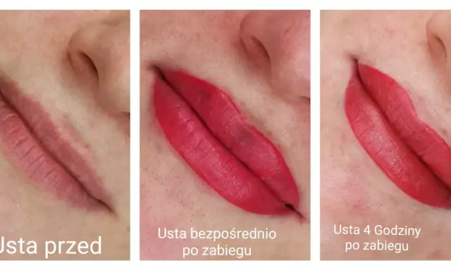 Makijaż permanentny ust: Gojenie dzień po dniu. Co Cię czeka?