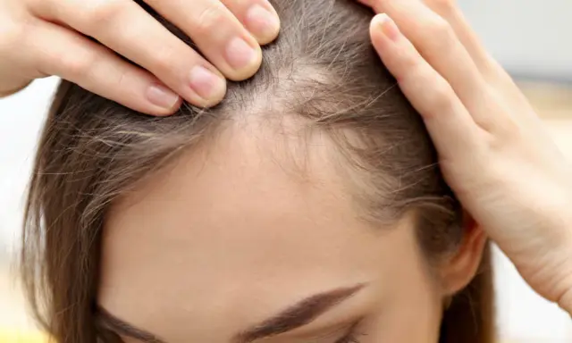 Delikatne baby hair przy linii czoła, widoczne na zbliżeniu.
