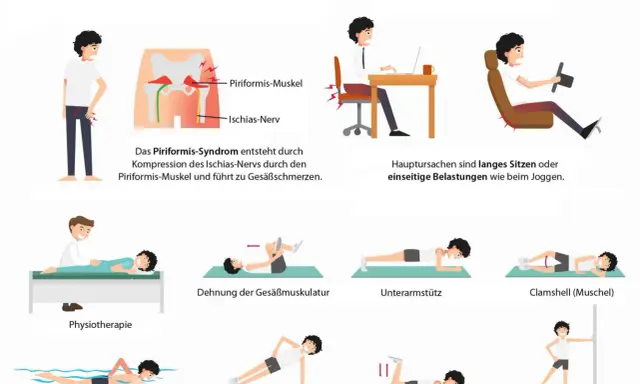 Illustrationen zeigen Übungen zur Linderung des Piriformis-Syndroms, wie Dehnung, Physiotherapie und Schwimmen. So kannst du den Piriformis trainieren.