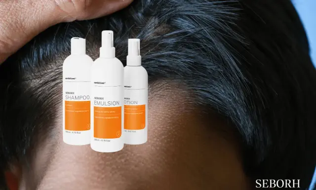 Trzy białe butelki z pomarańczowymi etykietami: szampon, emulsja i lotion SEBORH. Pomagają w walce z łzs.