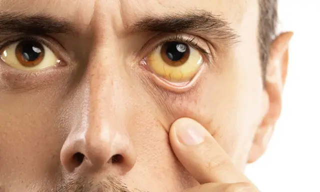 Zespół Gilberta a psychika: Lęk, mgła mózgowa? Jak odzyskać spokój