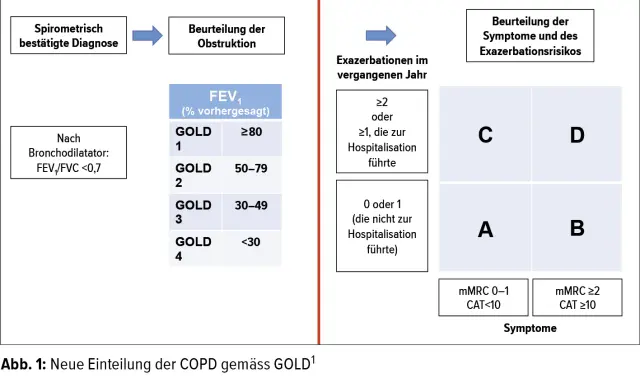 Schema zur Einteilung der COPD-Stadien nach GOLD, basierend auf Obstruktion, Exazerbationen und Symptomen.