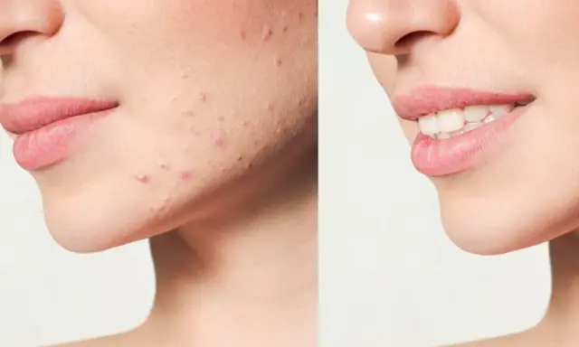 Twoja cera marzeń: Jak poprawić wygląd od diety po retinol?