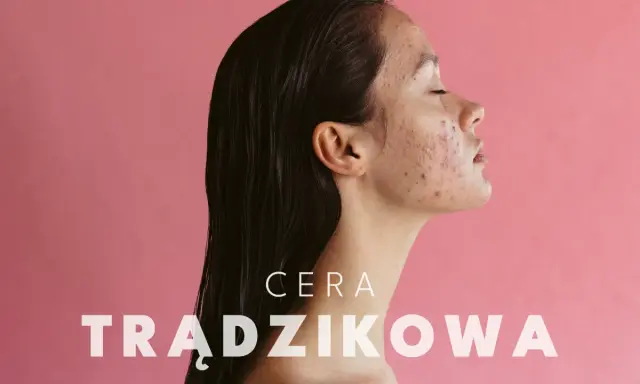 Cera trądzikowa: Jak dbać? Kompletny poradnik ekspertki