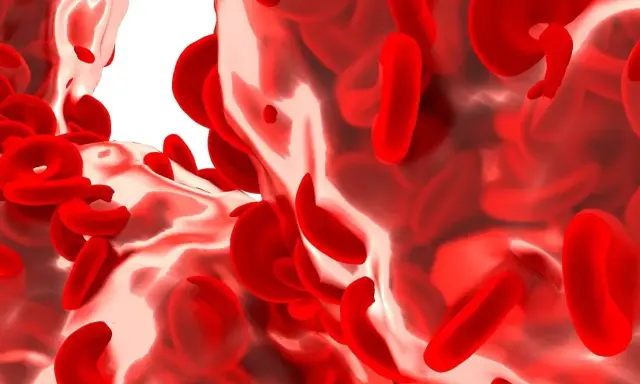 Podwyższona hemoglobina: Kiedy martwić się wynikiem badań?