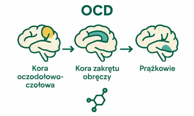 Schemat mózgu ilustrujący zaburzenia obsesyjno-kompulsyjne (OCD) i zmiany w korze oczodołowo-czołowej, korze zakrętu obręczy i jądrach podstawy.